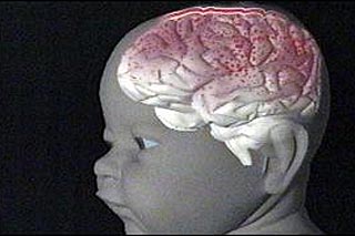 20101226130728-cerebro-bebe-dolor.jpg